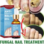 7Days Effect Fungal Nail Treatment Oil Foot Repair Essence Toe Nail Fungus Removal Gel Anti Infection Cream Fungal Nail Removal