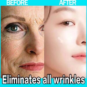 Effective anti-ageing and anti-wrinkle facial serum to remove facial wrinkles fine lines around the eyes crow's feet neck wrinkl