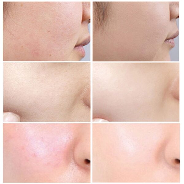 Salicylic Acid Pore Shrink Face Serum Hyaluronic Acid Moisturizing Nourish Smooth Pores Repair Essence Firm Skin Korean Cosmetic - Image 2