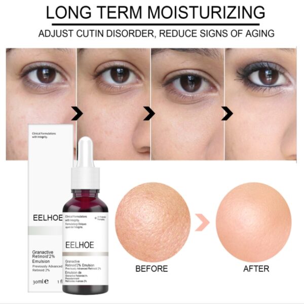 Salicylic Acid Pore Shrink Face Serum Hyaluronic Acid Moisturizing Nourish Smooth Pores Repair Essence Firm Skin Korean Cosmetic - Image 3