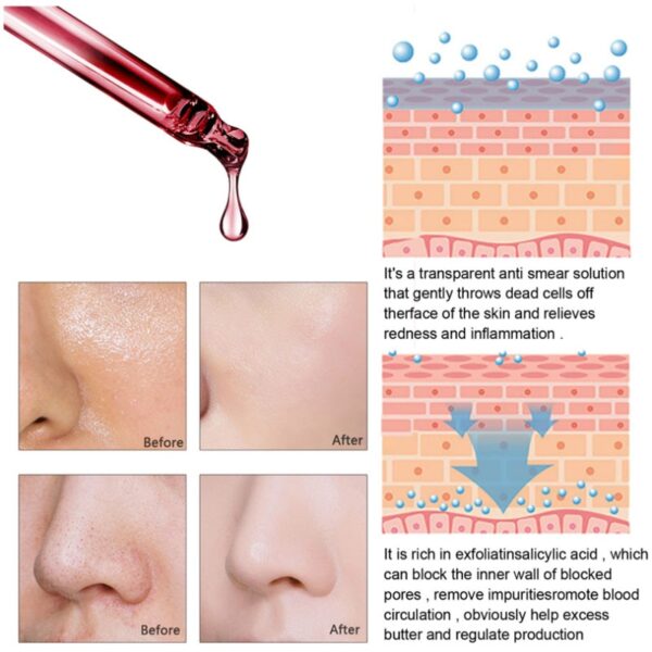 Salicylic Acid Pore Shrink Face Serum Hyaluronic Acid Moisturizing Nourish Smooth Pores Repair Essence Firm Skin Korean Cosmetic - Image 5